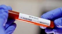 Intelijen Inggris Ungkap Virus Covid-19 Hasil Modifikasi Ilmuwan China di Lab Wuhan